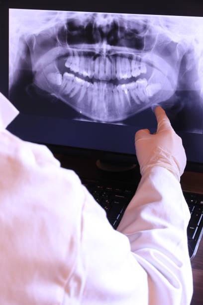 Best Broken or Chipped Tooth Repair in Shougal, WA